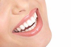 Woman smiling with white teeth